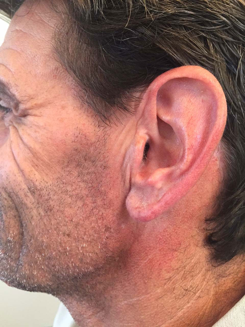 Cas_3_profil_rapproche Cas_3_profil_rapproche
